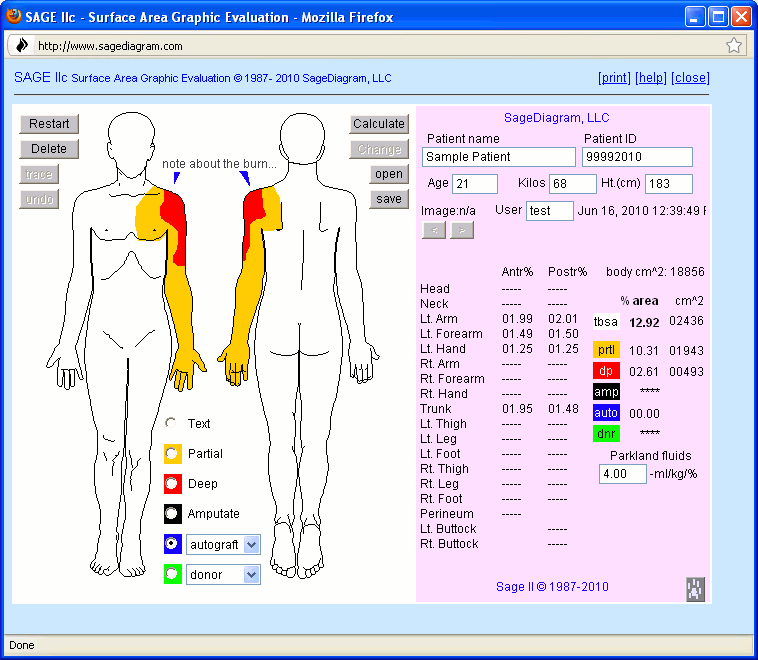 burn how sage sample SageDiagram.com screen II SAGE Diagramming Burn burn how sage sample SageDiagram.com screen II SAGE Diagramming Burn